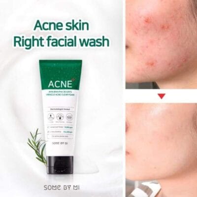 SOME BY MI AHA,BHA,PHA 30 Days Miracle Acne Clear Foam - Image 2