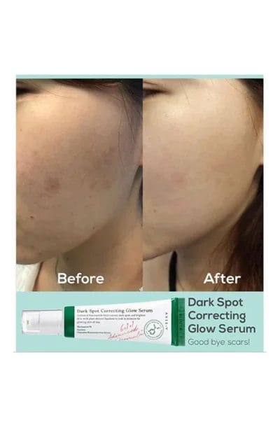 AXIS - Y - Dark Spot Correcting Glow SerumAXIS - Y - Dark Spot Correcting Glow Serum